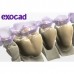 ExoCad - многофункциональное программное обеспечение для CAD-стоматологии