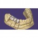 ExoCad - многофункциональное программное обеспечение для CAD-стоматологии