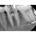 HDI1000 - стоматологический радиовизиограф