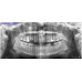 Planmeca ProOne - универсальный цифровой ортопантомограф