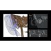 Дентальный томограф Hyperion X9 Pro с цефалостатом (13x16) (16х18 опция)