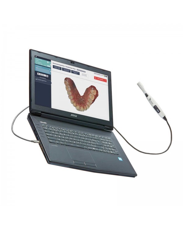 Condor - интраоральный сканер, ноутбук в комплекте