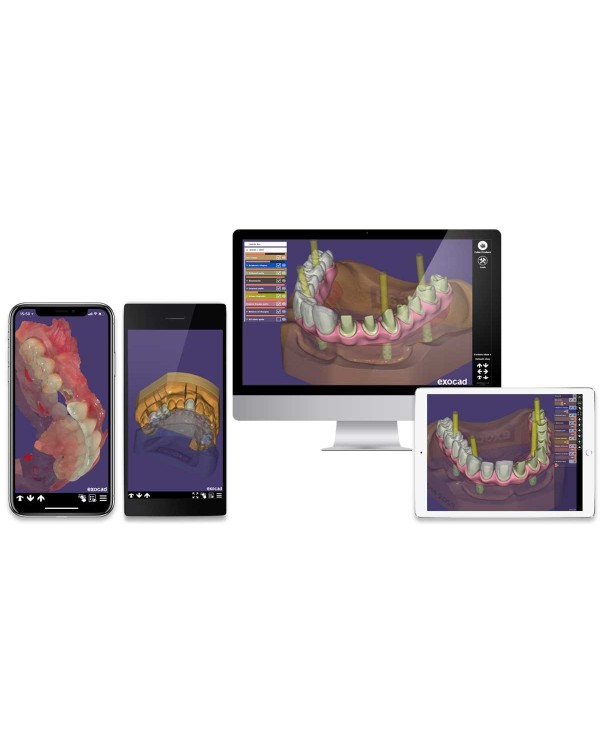 Exocad 2018 Valletta - программное обеспечение для компьютерного моделирования стоматологических реставраций