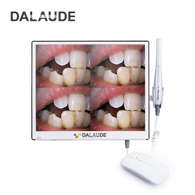 Интраоральная камера DA-300 Интраоральная камера DA-300