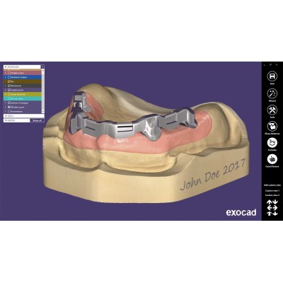 Exocad Bar Module - модуль для создания балочных конструкций Exocad Bar Module - модуль для создания балочных конструкций
