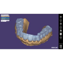 Exocad Bite Splint Module - модуль для создания терапевтических капп