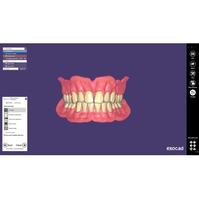 Exocad Full Denture Module - модуль для создания полносъемных протезов Exocad Full Denture Module - модуль для создания полносъемных протезов