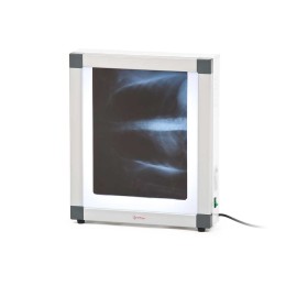 Негатоскоп общего назначения однокадровый