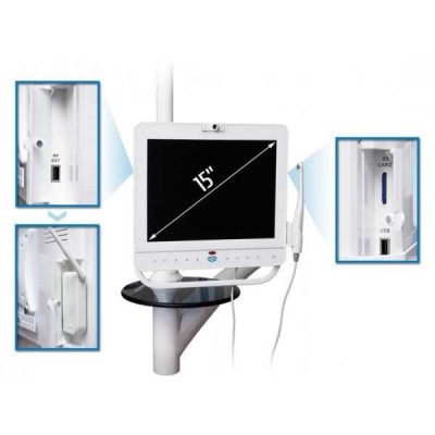 Super Cam 15 - комплекс визуализации Super Cam (15 дюймовый LCD-экран и беспроводная интраоральная камера) Super Cam 15 - комплекс визуализации Super Cam (15 дюймовый LCD-экран и беспроводная интраоральная камера)