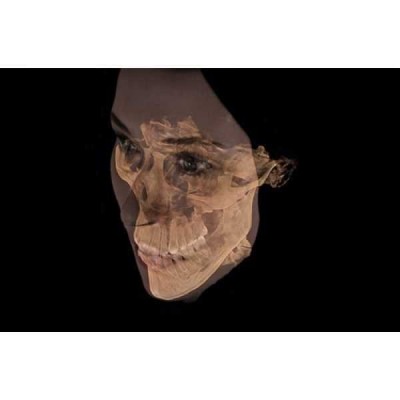 GALILEOS COMFORT PLUS - цифровое рентген устройство для получения высококачественных 3D-изображений всей зоны зубов GALILEOS COMFORT PLUS - цифровое рентген устройство для получения высококачественных 3D-изображений всей зоны зубов