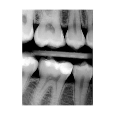 SuniRay2 - система компьютерной радиовизиографии SuniRay2 - система компьютерной радиовизиографии