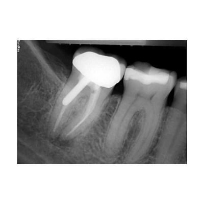 SuniRay2 - система компьютерной радиовизиографии SuniRay2 - система компьютерной радиовизиографии