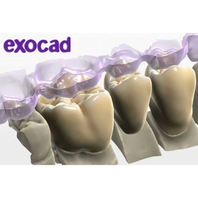 ExoCad - многофункциональное программное обеспечение для CAD-стоматологии ExoCad - многофункциональное программное обеспечение для CAD-стоматологии