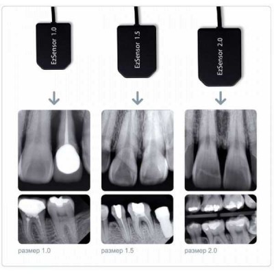 EzSensor - цифровой радиовизиограф EzSensor - цифровой радиовизиограф