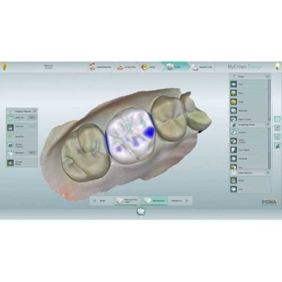 MyCrown - CAD/CAM-система полного цикла MyCrown - CAD/CAM-система полного цикла