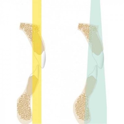 KaVo Pan eXam Plus 3D Ceph (2 датчика) - универсальный датчик Pan/Ceph для панорамной томографии, цефалостат, функция 3D-томографии 6x8 см KaVo Pan eXam Plus 3D Ceph (2 датчика) - универсальный датчик Pan/Ceph для панорамной томографии, цефалостат, функция 3D-томографии 6x8 см