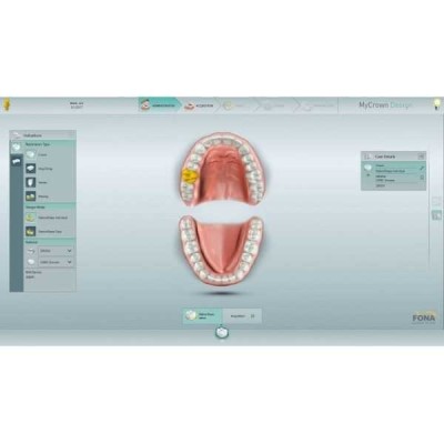 MyCrown - CAD/CAM-система полного цикла MyCrown - CAD/CAM-система полного цикла