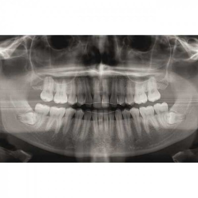 KaVo Pan eXam Plus 3D Ceph (2 датчика) - универсальный датчик Pan/Ceph для панорамной томографии, цефалостат, функция 3D-томографии 6x8 см KaVo Pan eXam Plus 3D Ceph (2 датчика) - универсальный датчик Pan/Ceph для панорамной томографии, цефалостат, функция 3D-томографии 6x8 см