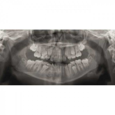 GENDEX GXDP-300 - цифровая панорамная рентгенодиагностическая система GENDEX GXDP-300 - цифровая панорамная рентгенодиагностическая система