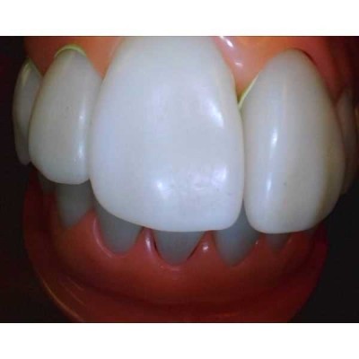 Whicam VI - беспроводная интраоральная камера, комплектация VI Whicam VI - беспроводная интраоральная камера, комплектация VI