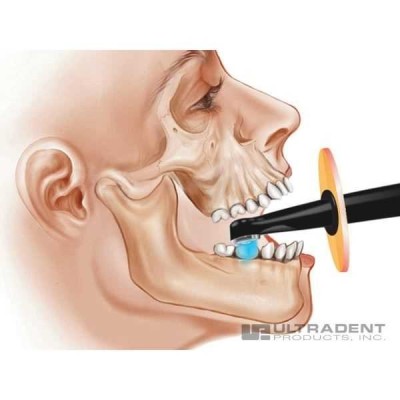 VALO - проводная светодиодная фотополимеризационная лампа c тремя режимами полимеризации VALO - проводная светодиодная фотополимеризационная лампа c тремя режимами полимеризации