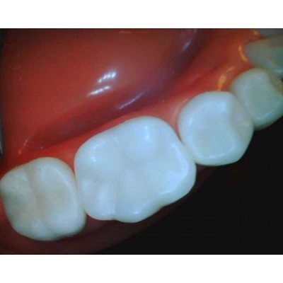 Whicam VI - беспроводная интраоральная камера, комплектация VI Whicam VI - беспроводная интраоральная камера, комплектация VI