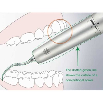 Ti-Max S970SL - пневматический скалер с оптикой (для переходника Sirona) Ti-Max S970SL - пневматический скалер с оптикой (для переходника Sirona)