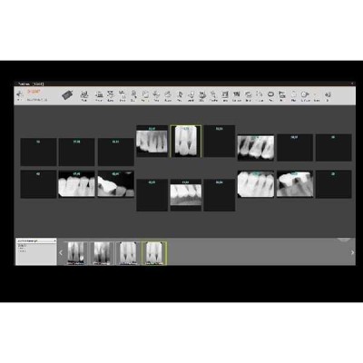 X-RAY SENSOR E9525 - радиовизиографическая система X-RAY SENSOR E9525 - радиовизиографическая система