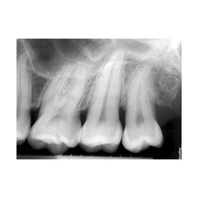 SuniRay2 - система компьютерной радиовизиографии SuniRay2 - система компьютерной радиовизиографии