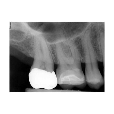 SuniRay2 - система компьютерной радиовизиографии SuniRay2 - система компьютерной радиовизиографии