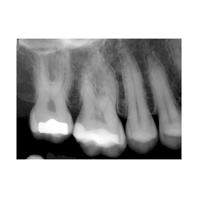 SuniRay2 - система компьютерной радиовизиографии SuniRay2 - система компьютерной радиовизиографии