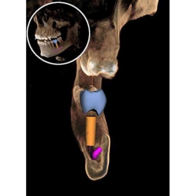 GALILEOS COMFORT PLUS - цифровое рентген устройство для получения высококачественных 3D-изображений всей зоны зубов GALILEOS COMFORT PLUS - цифровое рентген устройство для получения высококачественных 3D-изображений всей зоны зубов