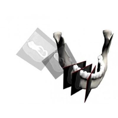 Hyperion X7 - цифровой ортопантомограф с функцией 3DTS Hyperion X7 - цифровой ортопантомограф с функцией 3DTS