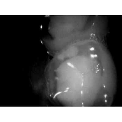 VistaCam IX - интраоральная видеокамера с головками Cam, Proof VistaCam IX - интраоральная видеокамера с головками Cam, Proof