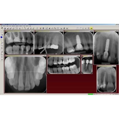 Digora Optime Classic - беспроводной визиограф в комплекте с 6-ю тонкими датчиками размера 31x41 мм Digora Optime Classic - беспроводной визиограф в комплекте с 6-ю тонкими датчиками размера 31x41 мм