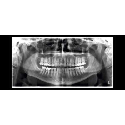 Planmeca ProMax 2D SCARA 2 - рентгеновская установка без цефалостата Planmeca ProMax 2D SCARA 2 - рентгеновская установка без цефалостата