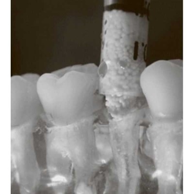 Easy Graft Classic 0,400 мл - синтетический костнозамещающий материал Easy Graft Classic 0,400 мл - синтетический костнозамещающий материал