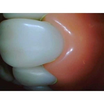 Whicam VI - беспроводная интраоральная камера, комплектация VI Whicam VI - беспроводная интраоральная камера, комплектация VI