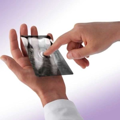 X-pod - беспроводная цифровая радиовизиографическая система X-pod - беспроводная цифровая радиовизиографическая система