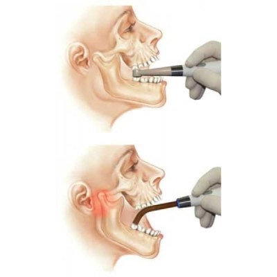 Эстус ЛЭД-Алладин (Multicolor) - беспроводной многофункциональный стоматологический светодиодный фотоактиватор Эстус ЛЭД-Алладин (Multicolor) - беспроводной многофункциональный стоматологический светодиодный фотоактиватор