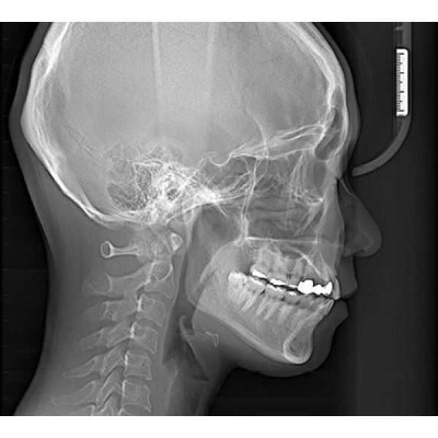 RAYSCAN Symphony a-3D - ортопантомограф с компьютерным томографом, 3D 9х9 см RAYSCAN Symphony a-3D - ортопантомограф с компьютерным томографом, 3D 9х9 см