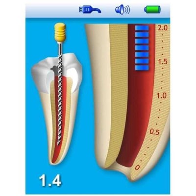 Апекслокатор Bingo Pro полностью автоматический с функцией виртуального апекса Апекслокатор Bingo Pro полностью автоматический с функцией виртуального апекса