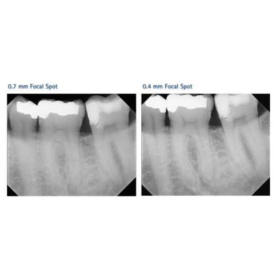 Gendex Expert DC 65 - высокочастотный настенный рентгеновский аппарат, длина консоли 165 см Gendex Expert DC 65 - высокочастотный настенный рентгеновский аппарат, длина консоли 165 см
