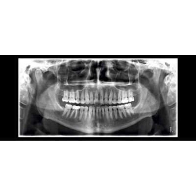 Planmeca ProMax 2D SCARA 2 - рентгеновская установка с цефалостатом Planmeca ProMax 2D SCARA 2 - рентгеновская установка с цефалостатом