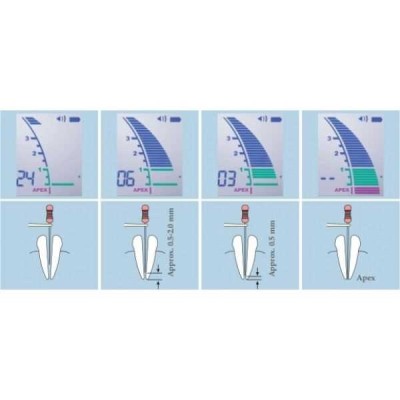 Апекслокатор Root ZX mini стоматологический Апекслокатор Root ZX mini стоматологический