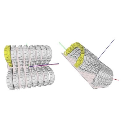 Basic (Dental) - профессиональный 3D-принтер для стоматологии Basic (Dental) - профессиональный 3D-принтер для стоматологии