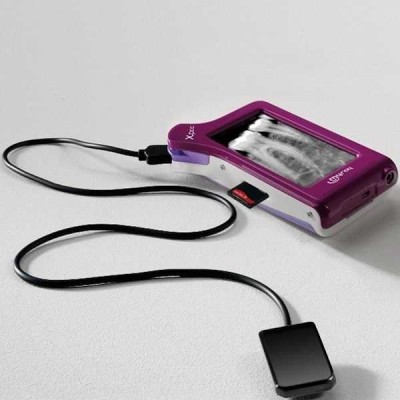 X-pod - беспроводная цифровая радиовизиографическая система X-pod - беспроводная цифровая радиовизиографическая система