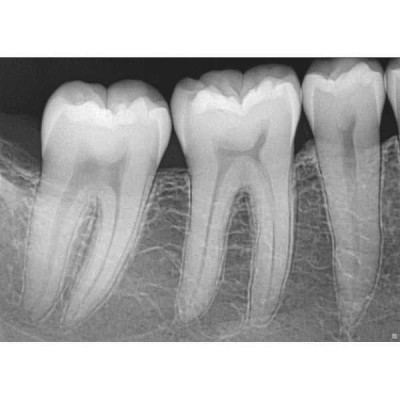 XIOS XG SUPREME USB MODUL - модульная сенсорная система со сменный кабелем XIOS XG SUPREME USB MODUL - модульная сенсорная система со сменный кабелем