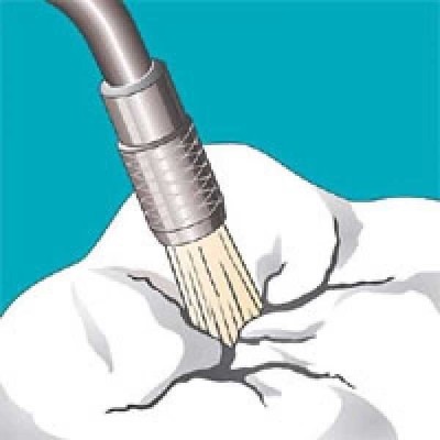 Sonicflex clean - набор насадок и щетки Sono для профессиональной механической чистки зубов (снятия зубных отложений) Sonicflex clean - набор насадок и щетки Sono для профессиональной механической чистки зубов (снятия зубных отложений)