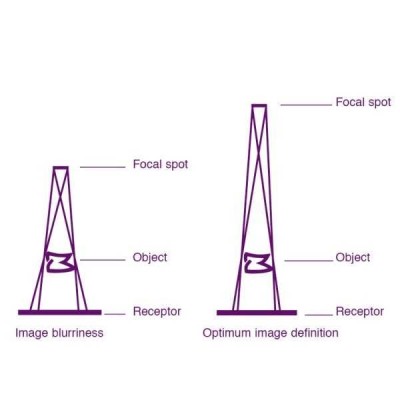 RXDC eXTend - высокочастотный настенный рентгеновский аппарат RXDC eXTend - высокочастотный настенный рентгеновский аппарат